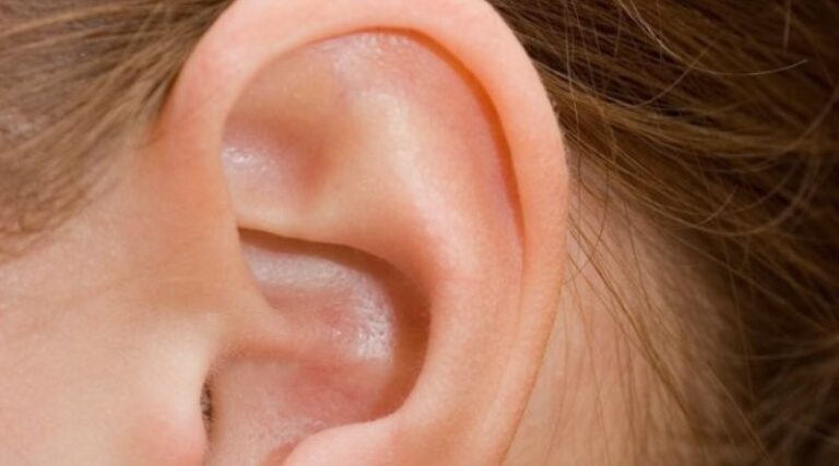 Hearing Loss: Symptoms, Causes, and Treatments